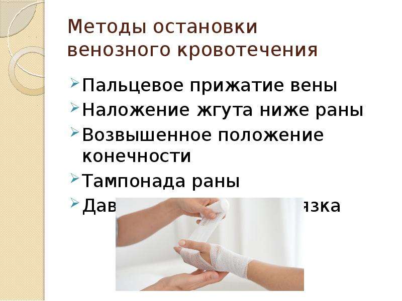 Виды кровотечений способы остановки кровотечений презентация