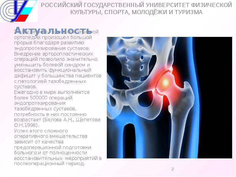 Эндопротезирование тазобедренного сустава презентация