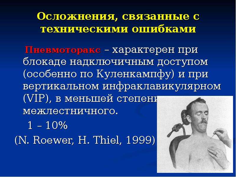 Анестезия по берше. Проводниковая блокада по Куленкампфу. Осложнения проводниковой анестезии. Надключичная блокада по Куленкампфу. Проводниковая анестезия по Куленкампфу.