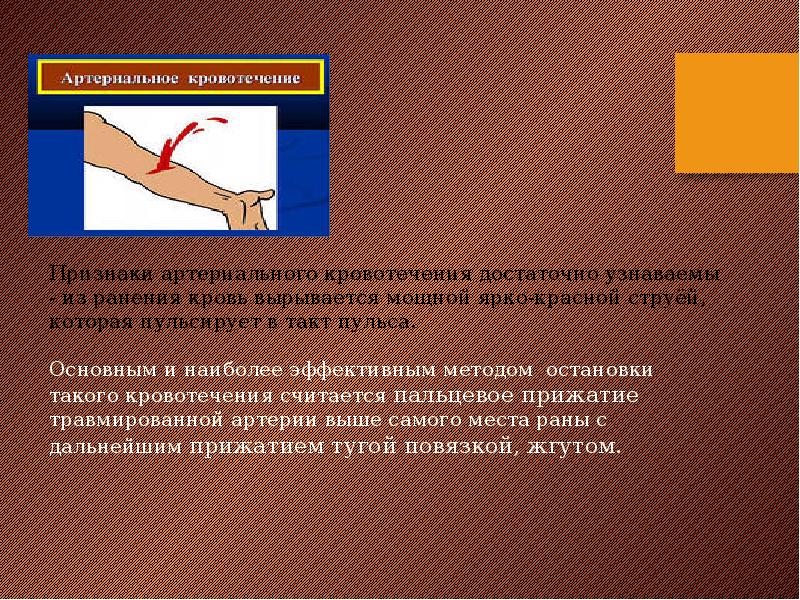 Виды кровотечений способы остановки кровотечений презентация