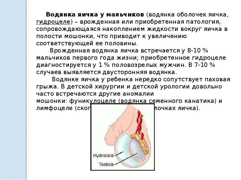 Водянка яичка карта вызова смп