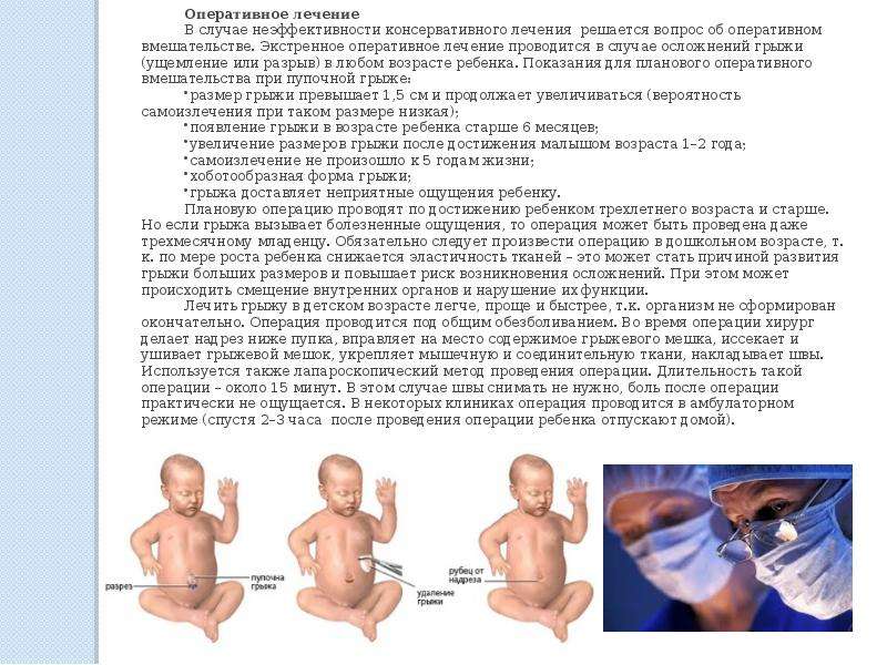 Грыжа белой линии живота у детей. Грыжа белой линии живота у ребенка. Грыжа белой линии живота у новорожденного. Грыжа белой линии у новорожденного.