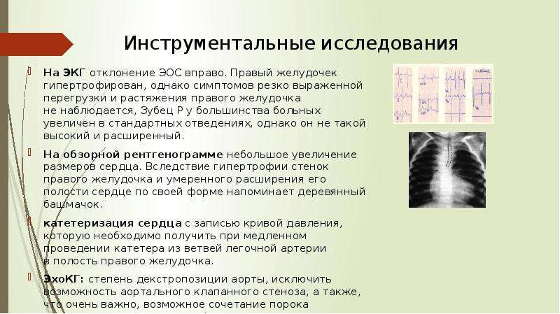 Отклонения на экг. Ось отклонена вправо на ЭКГ. Отклонение электрической оси на ЭКГ. Электрическая ось сердца отклонена. Отклонение электрической оси сердца вправо на ЭКГ.