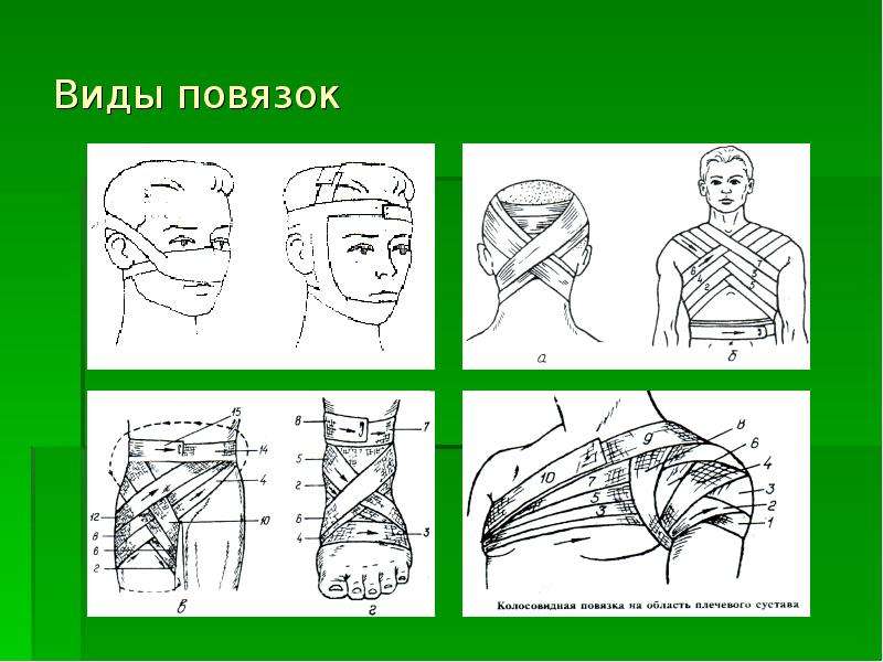 презентация на тему: "наложение повязок" Foto 19