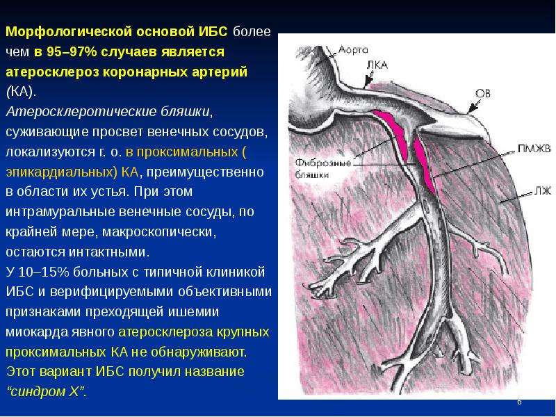 Ишемия передней стенки. Интрамуральный ход коронарных артерий. Эпикардиальных артерий. Интрамуральные коронарные артерии. Интрамуральные сосуды сердца.
