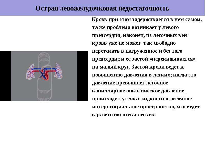 Левожелудочковая недостаточность карта вызова