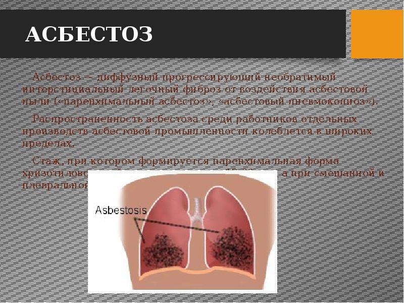 Асбестоз это. Асбестоз осложнения.