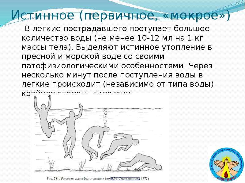 Истинное утопление. Патогенез утопления в пресной воде. Утопление в пресной и морской воде. Утопление презентация. Для истинного утопления в пресной воде характерно:.