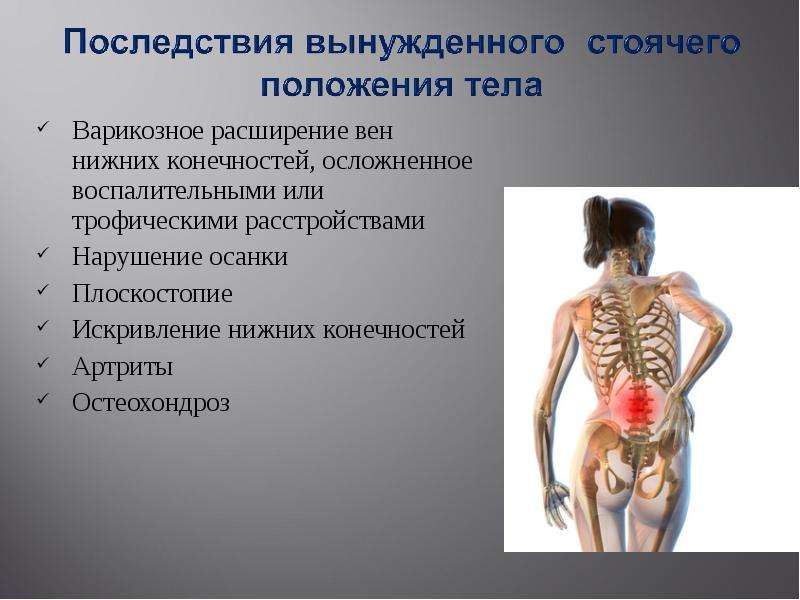 Факторы риска стрессы гиподинамия переутомление переохлаждение проект