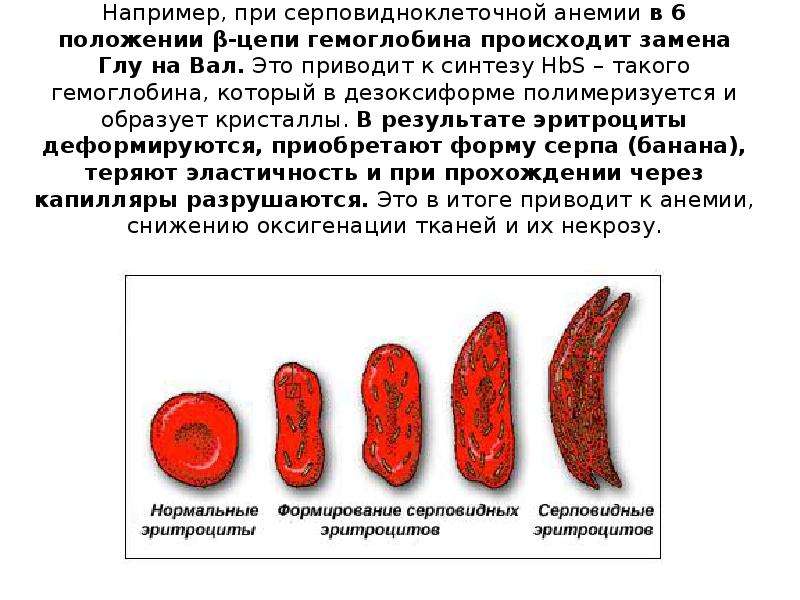 В6 анемия. Строение гемоглобина при серповидноклеточной анемии. Гемоглобин s при серповидноклеточной анемии. При серповидно-клеточной анемии гемоглобин:. Основной Тип гемоглобина при серповидноклеточной анемии.