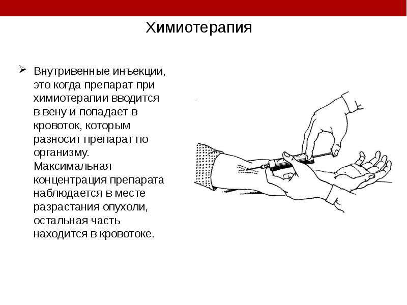 Роль химии в лечении онкологических заболеваний проект