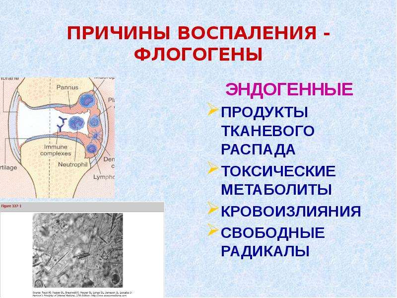 Почему воспаление. Эндогенные флогогены. Эндогенные метаболиты. Продукты тканевого распада. Токсические метаболиты.