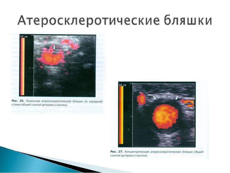 Презентации к исследованию сосудов