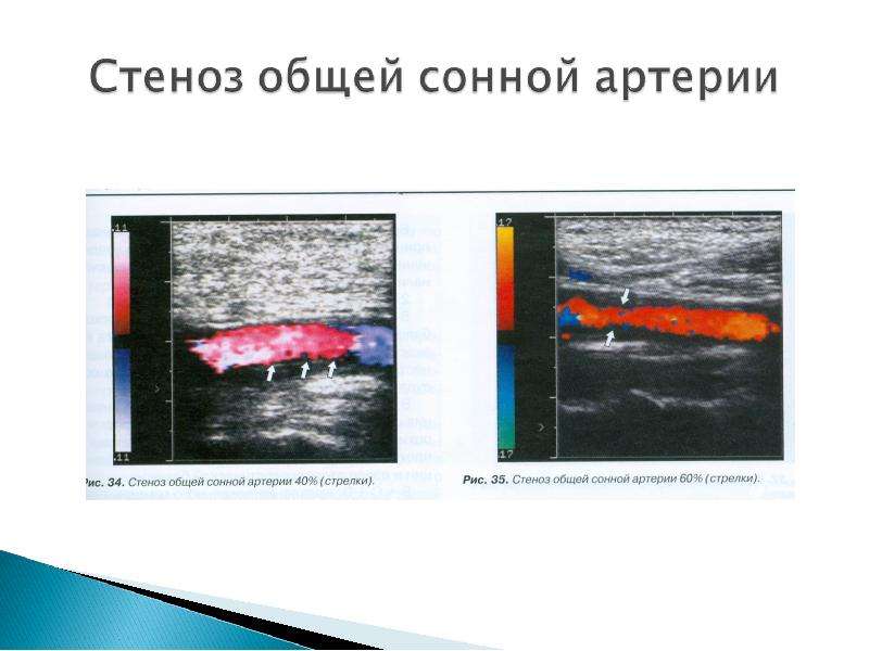 Презентации к исследованию сосудов