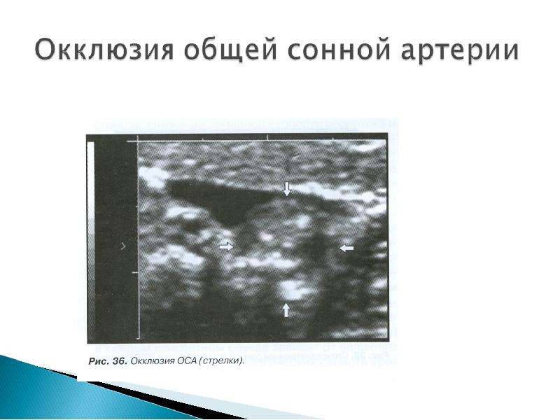 Презентации к исследованию сосудов