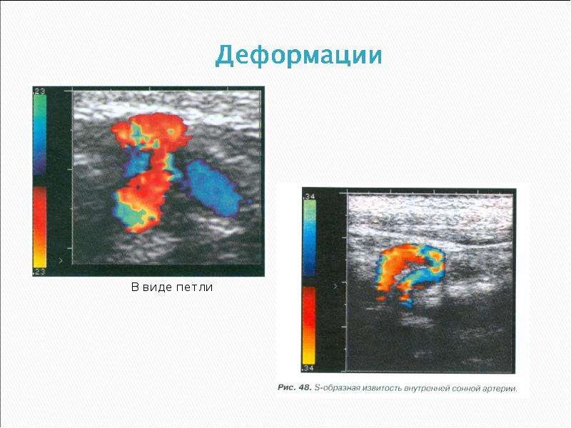 Презентации к исследованию сосудов