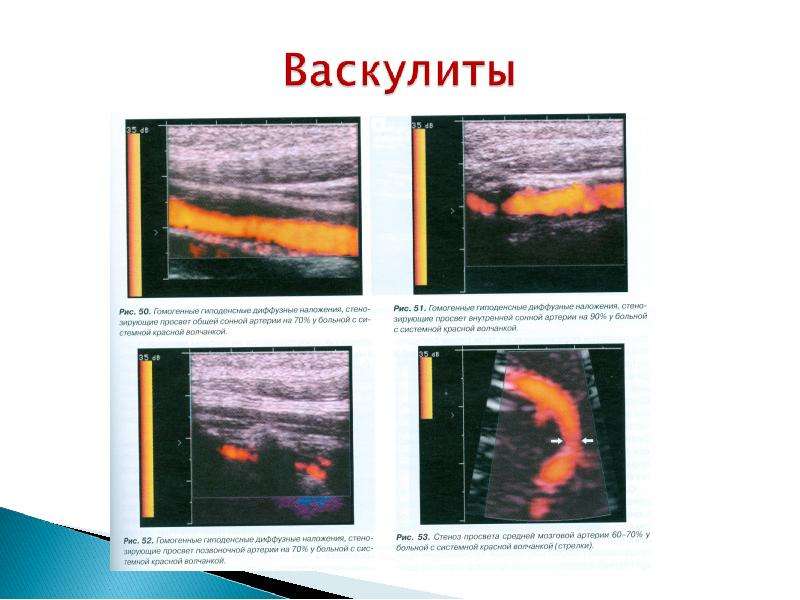 Презентации к исследованию сосудов