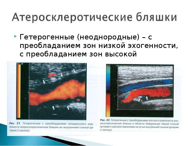 Презентации к исследованию сосудов