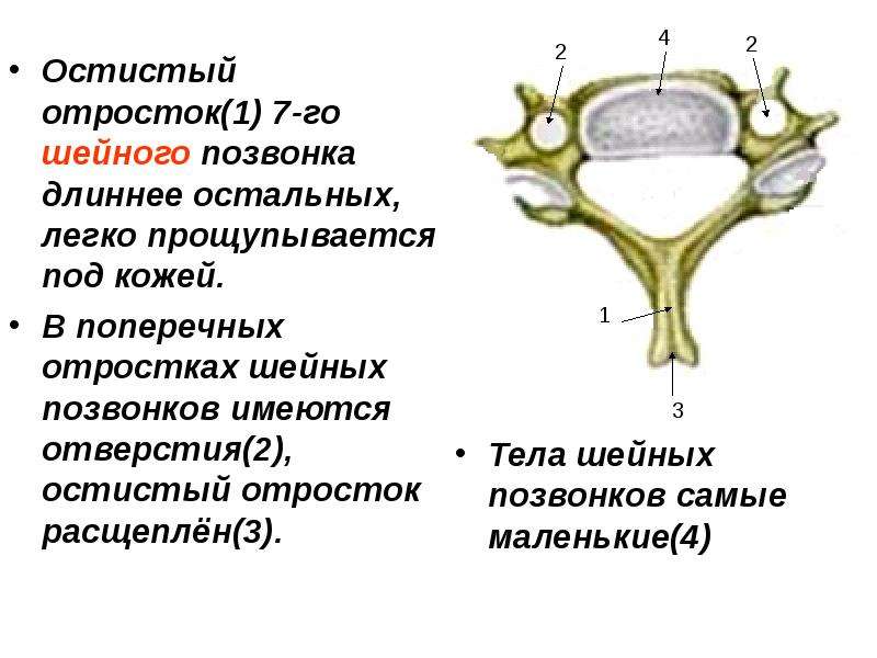 Остистый отросток 7 шейного позвонка фото