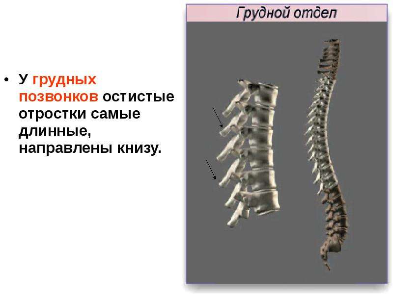 Презентация на тему позвоночник