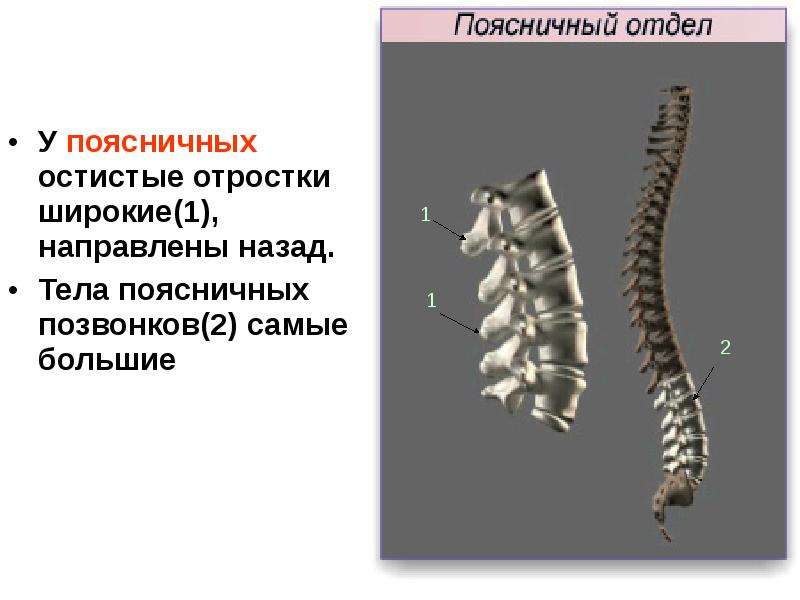 Остистые отростки позвоночника фото