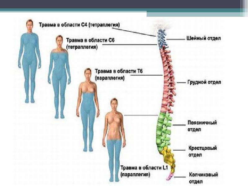 Травмы центральной нервной системы, слайд 8