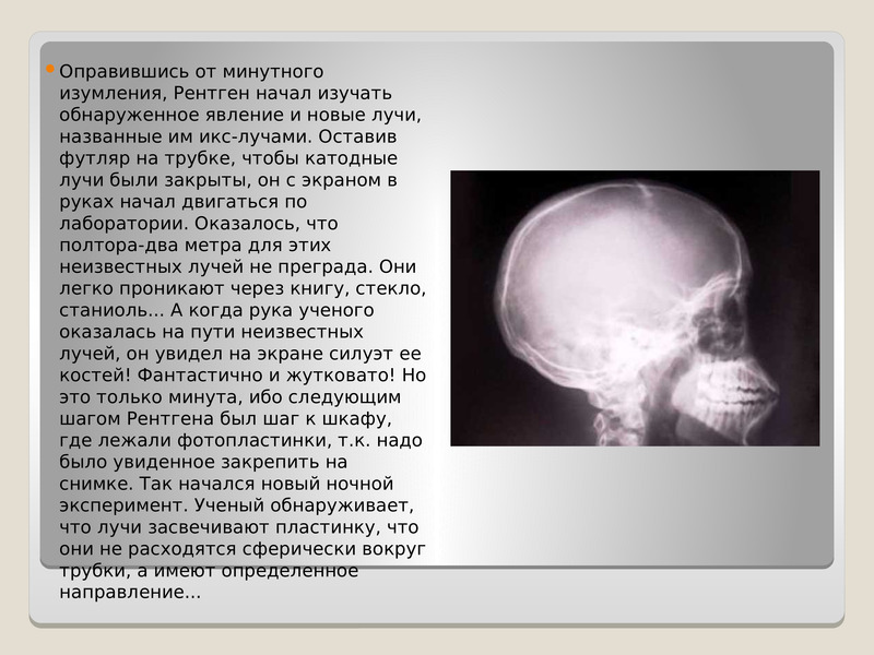 Рентген отзывы. Рентген презентация. Рентген ученый презентация. Рентген Кондрат презентация. Рентген презентация на английском.