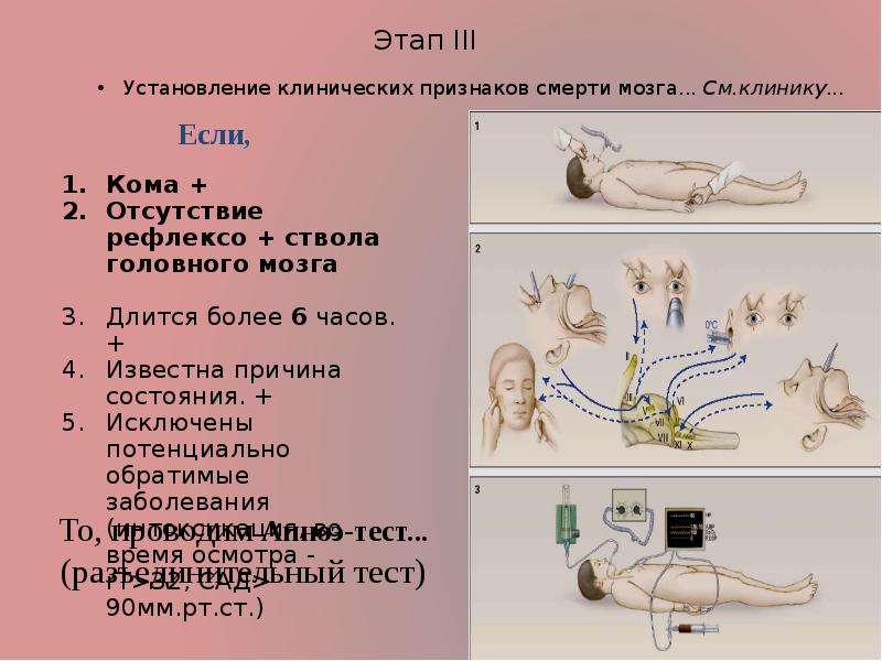 Кома мозг умирает