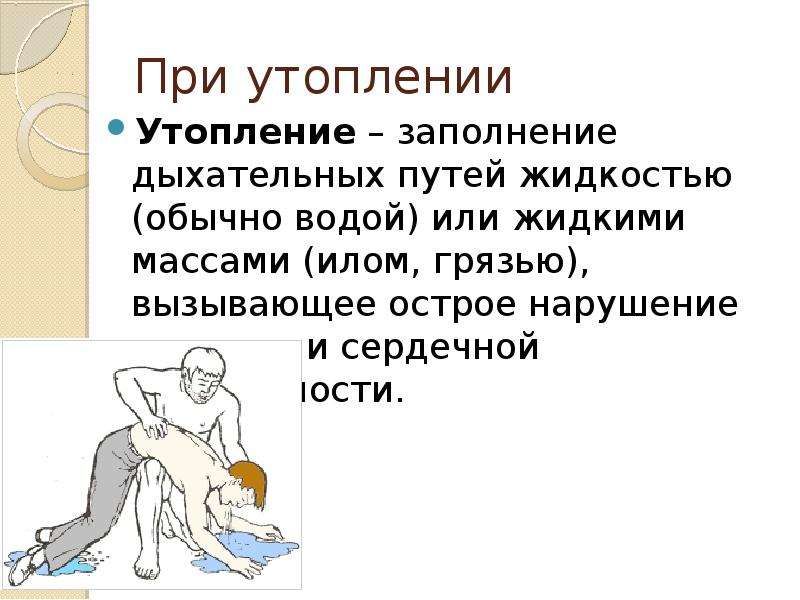 Признаки утопления тест