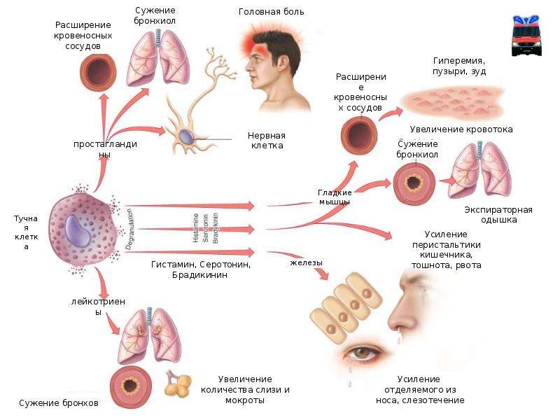 Аллергическая реакция презентация