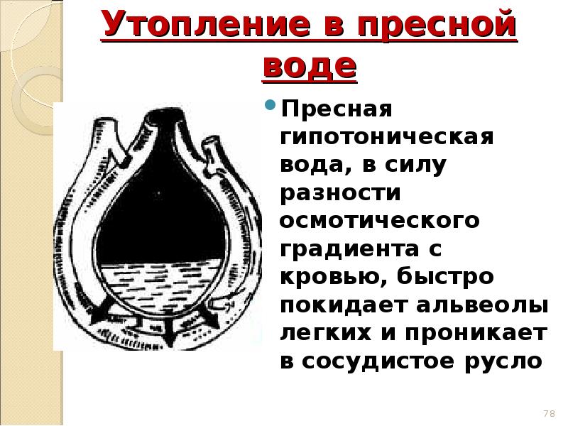 Утопление в пресной воде. Утопление в пресной воде клинические рекомендации. Утопление в пресной и морской воде. Утопление в пресной воде презентация.