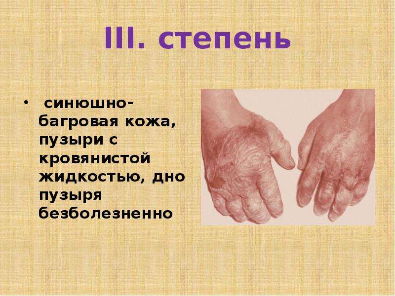 Синюшное окрашивание губ и кончиков пальцев называется. Кожа синюшно Багровая пузыри. Синюшный цвет конечностей. Кожные покровы багрово синюшные. Синюшно Багровый цвет кожи.