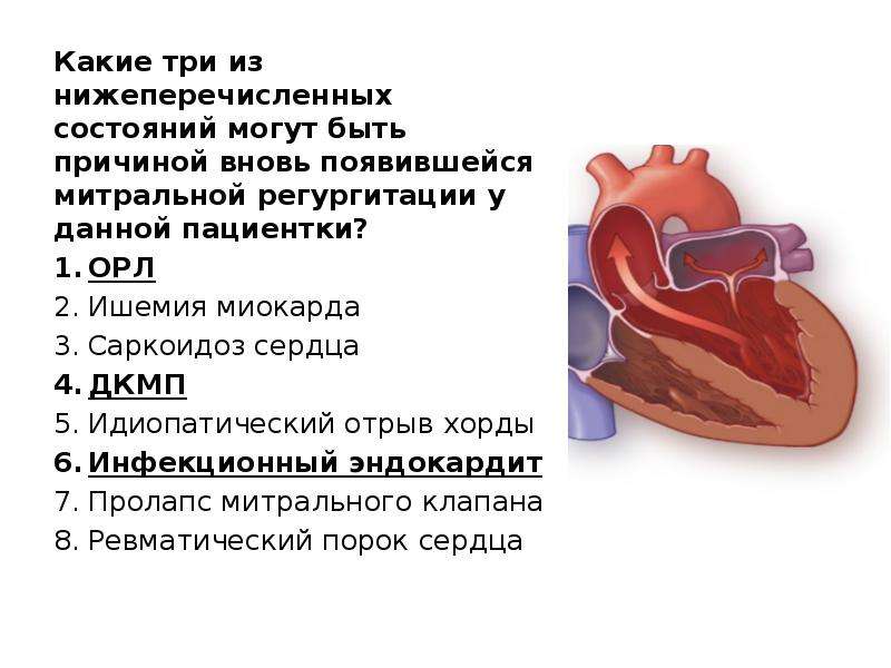 Митральная регургитация 2 степени. Регургитация митрального клапана 1-2.