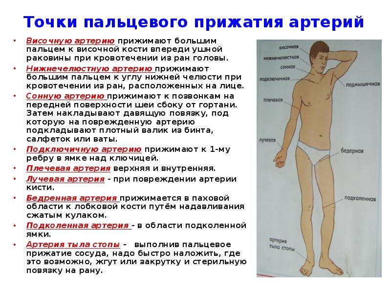 Пальцевое прижатие при повреждении бедренной артерии. Точки прижатия артерий. Точки пальцевого прижатия артерий. Точки прижатия артерий при кровотечении. Точки пальцевого прижатия артерий при кровотечении.