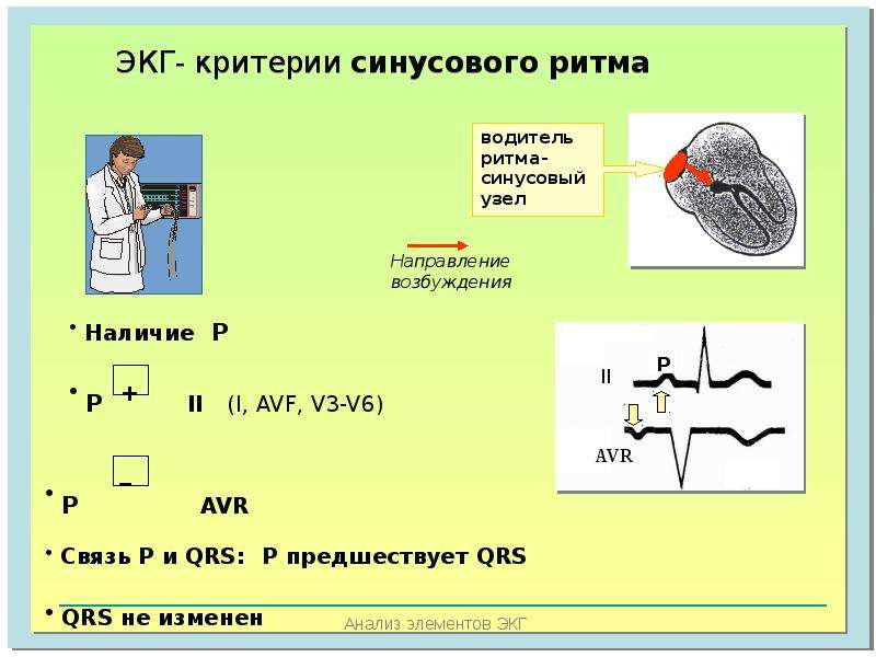 Основы экг презентация