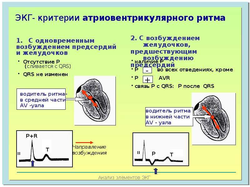 Узловой ритм сердца возникает когда роль водителя ритма берет на себя