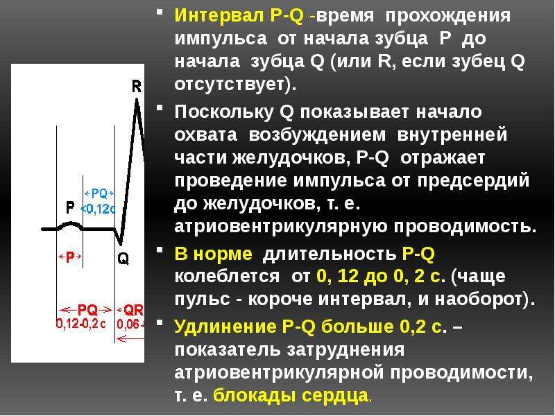 Основы экг презентация