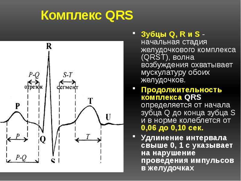 Волна возбуждения. Комплекс QRS на ЭКГ. Комплекс зубцов QRS на ЭКГ. Комплекс QRS на электрокардиограмме. ЭКГ комплекс QRST.