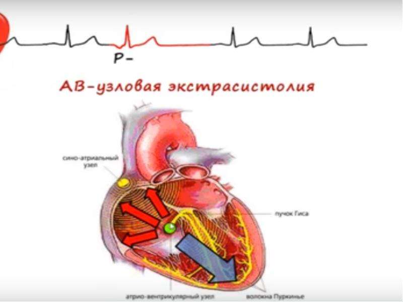 Физические основы электрокардиографии презентация