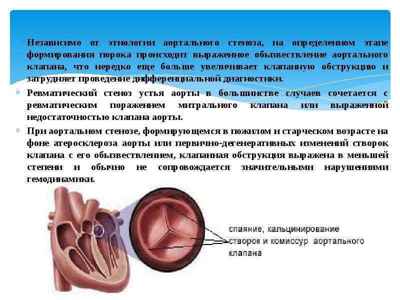 Аортальный стеноз презентация