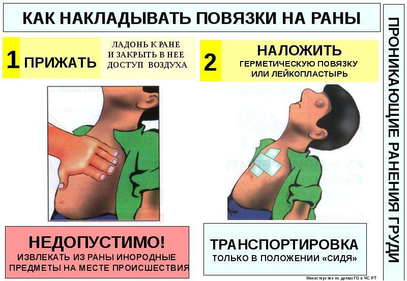 Наложение повязки на рану. Как наложить повязку на рану. Как накладываются повязки на раны. Как накладывать повязки. Обработка раны перед наложением повязки.