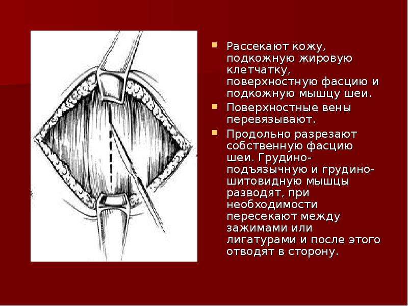 Картинки рассечет. Швы на подкожно жировую клетчатку. Кожа подкожная клетчатка поверхностная фасция.