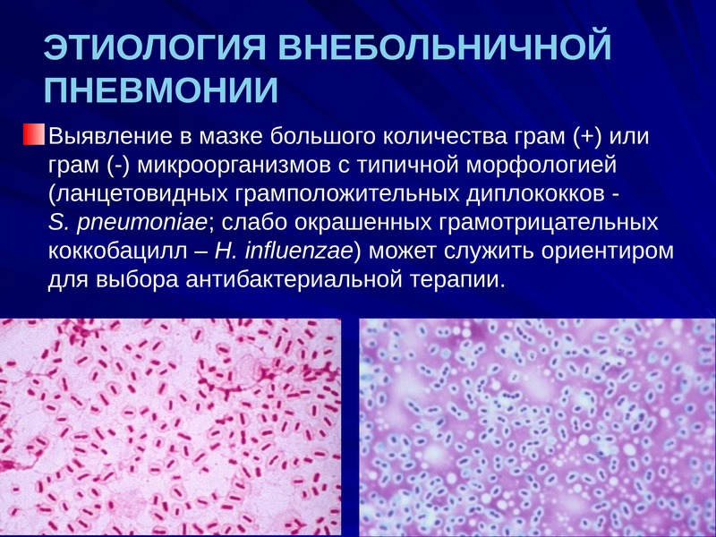 Внутрибольничная пневмония презентация