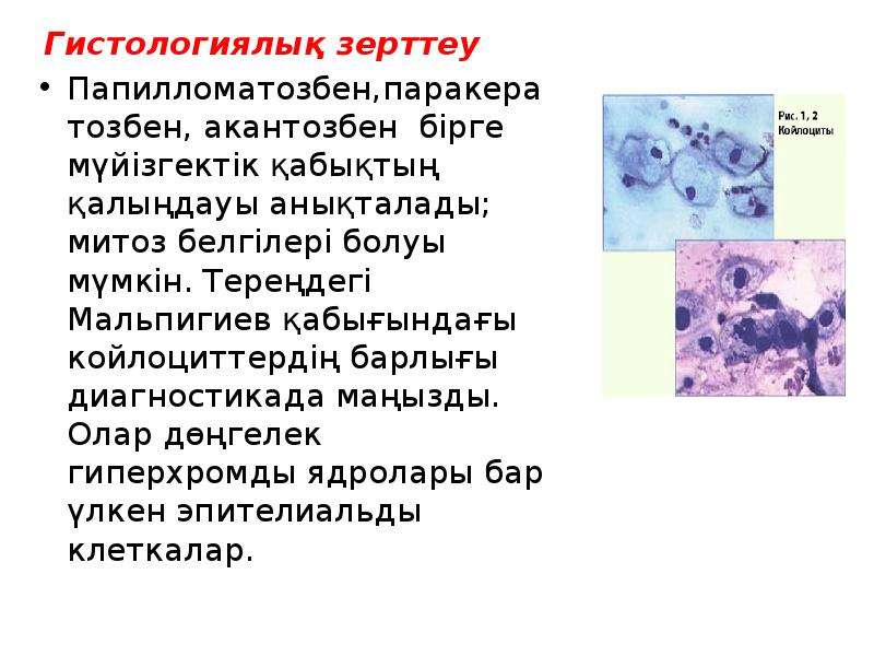 Аитв инфекциясы презентация