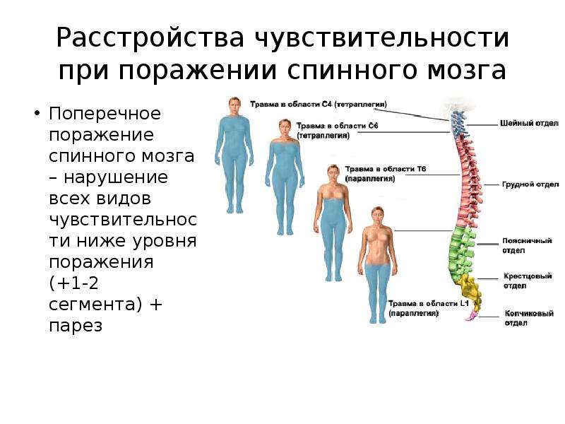 Поражение спинного. Поражение поперечника спинного мозга симптомы. Поражение грудного отдела спинного мозга. Синдромы при поражении сегментов спинного мозга. Уровень спинного мозга с1-th1.