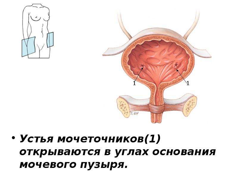 Устье мочеточника фото