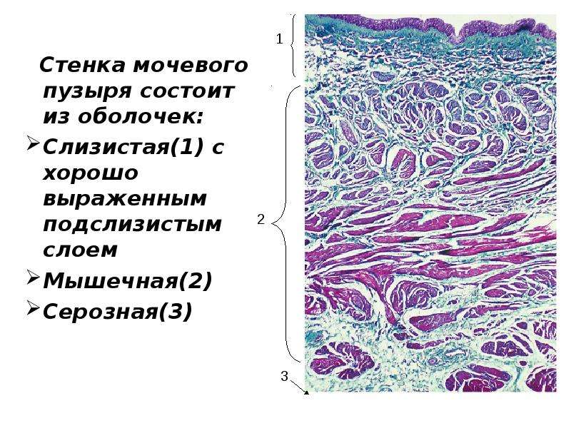 Стенки мочевого пузыря. Мочевой пузырь строение оболочки. Слизистая оболочка мочевого пузыря. Стенка мочевого пузыря гистология. Стенка мочевого пузыря состоит из оболочек.