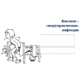 Коклюш – семинар часть3