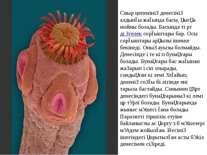 Гельминтоздар презентация қазақша