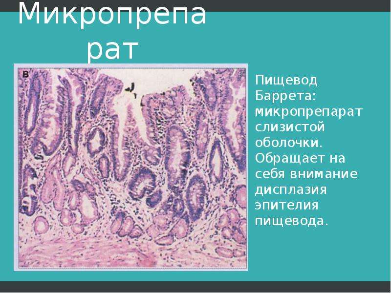 Патоморфологическая картина это